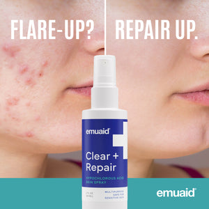 EMUAID Clear + Repair - Hypochlorige Säure Hautspray