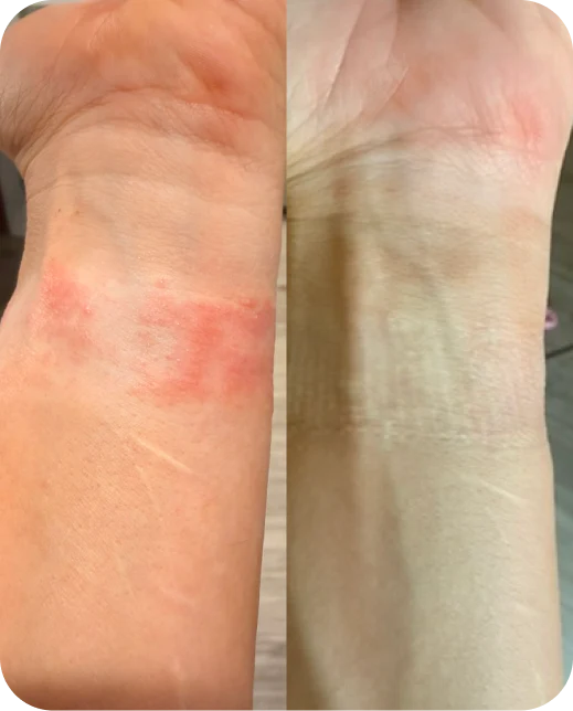 Ergebnisse klinischer Studien