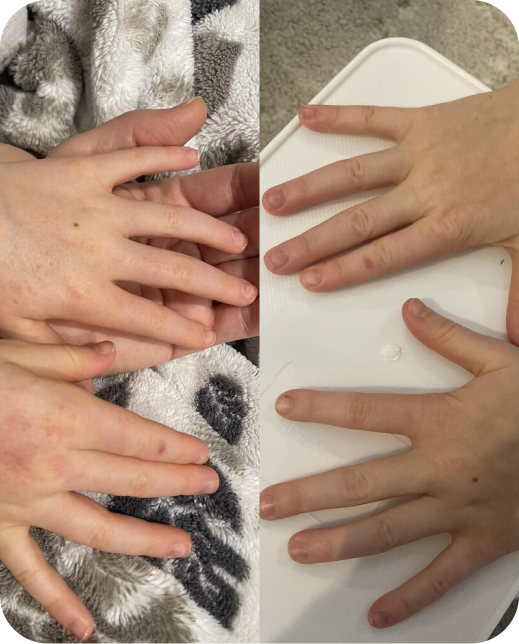 Ergebnisse klinischer Studien