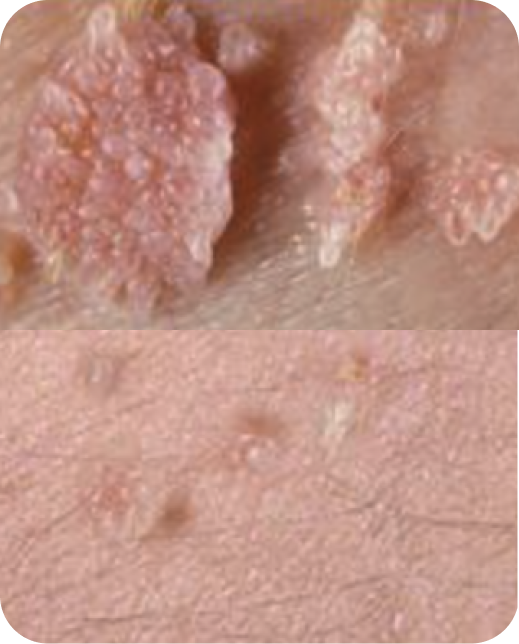 Ergebnisse klinischer Studien