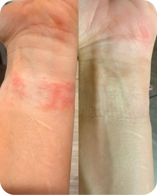 Ergebnisse klinischer Studien