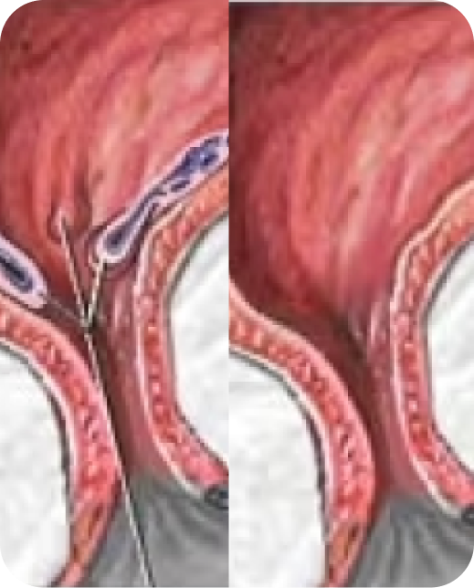 Ergebnisse klinischer Studien
