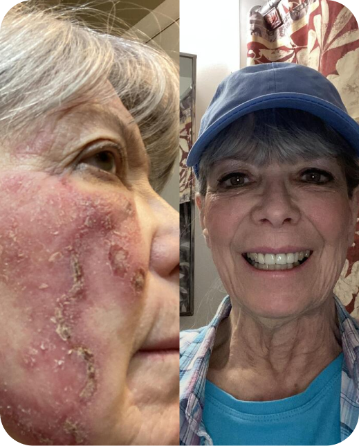 Ergebnisse klinischer Studien