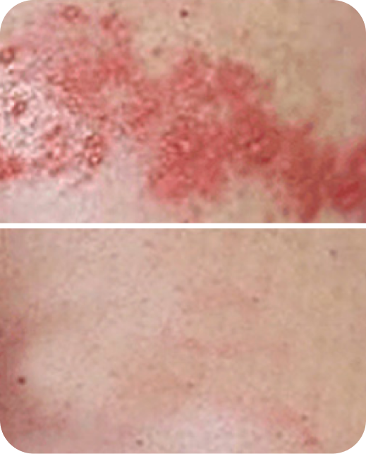 Ergebnisse klinischer Studien