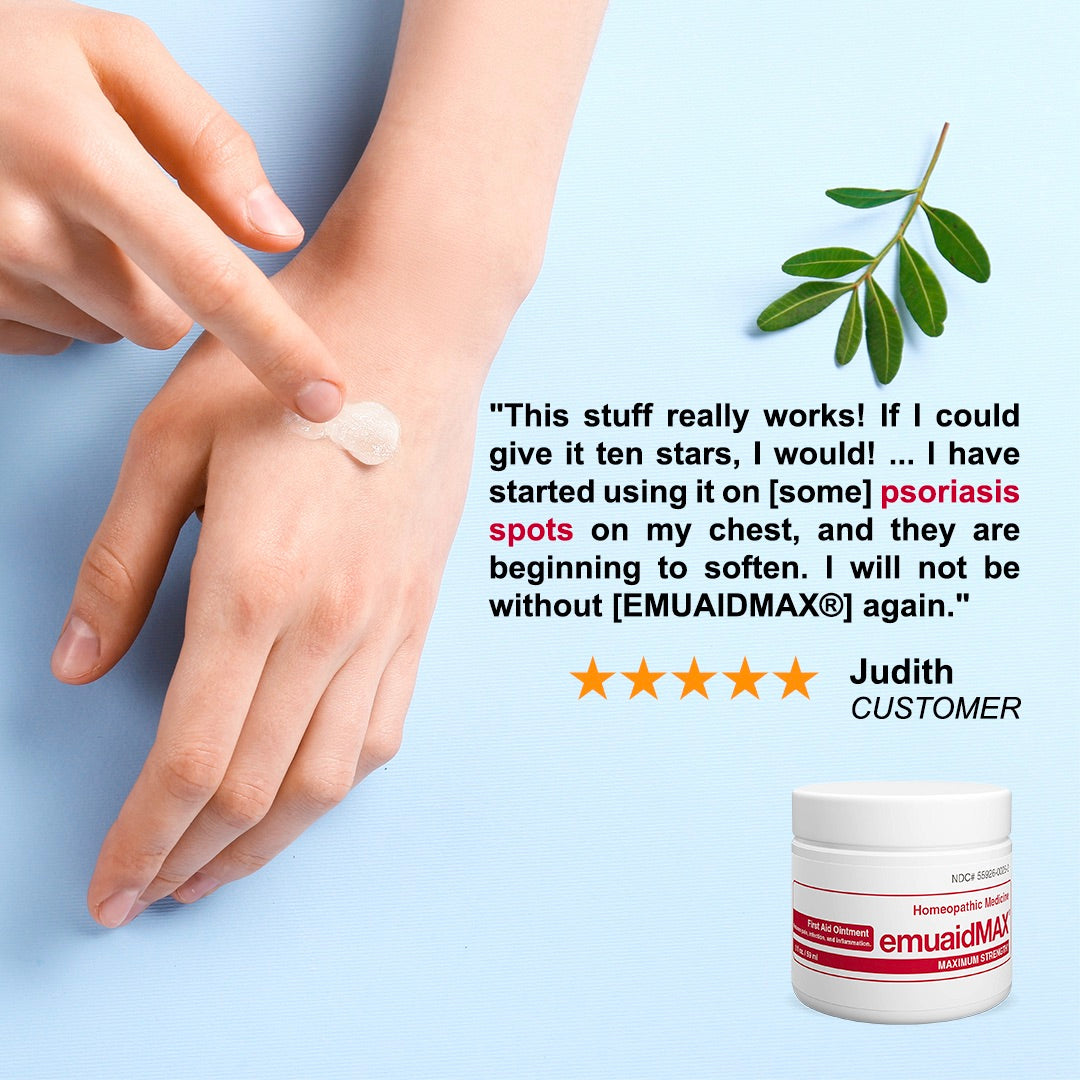 EMUAIDMAX® -Hilfe-Salbe 2 oz für Psoriasis