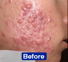 Ergebnisse klinischer Studien